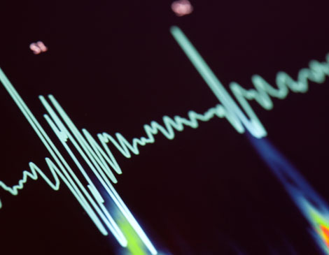 Heart Health Stock Heart Health Stock
